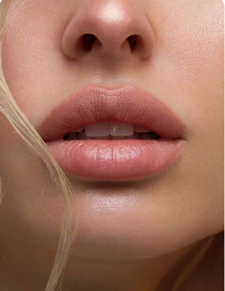 Relleno de Labios con Ácido Hialurónico